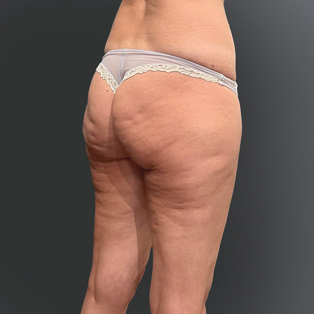 prima