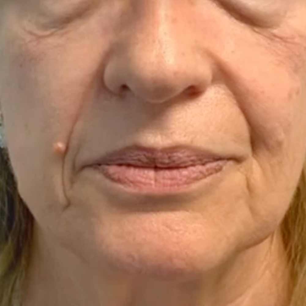 prima