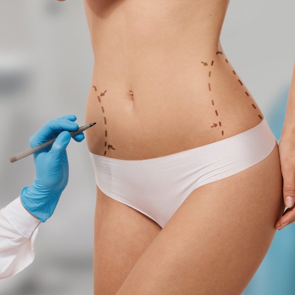 MINI-LIPO-OK